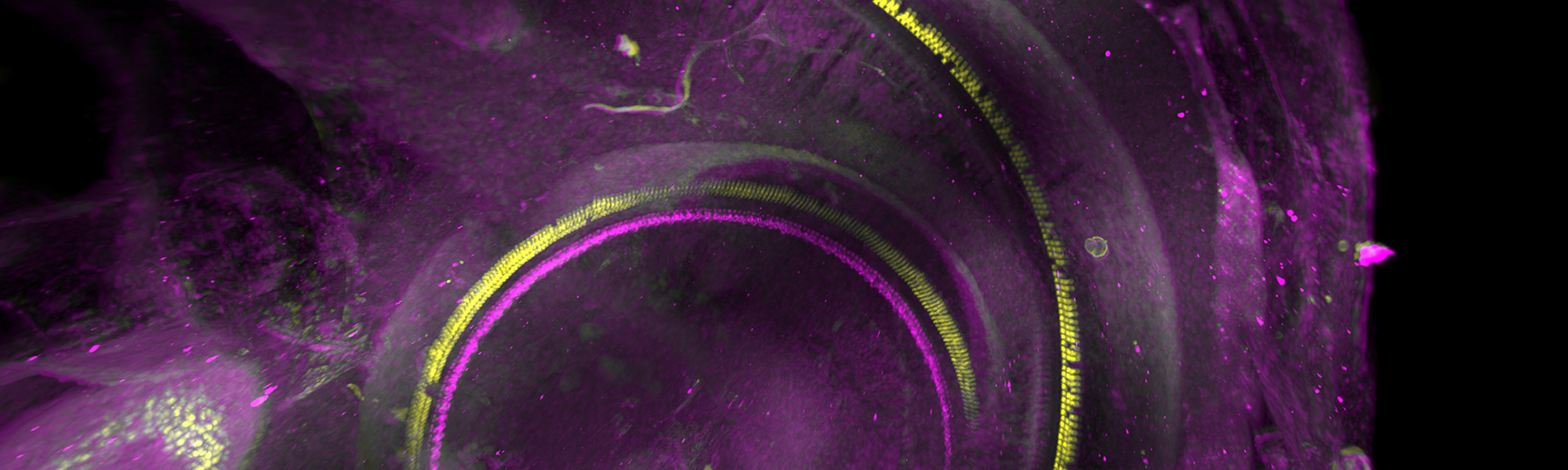 Trójwymiarowa model ucha z odrastającymi włoskami słuchowymi po leczeniu